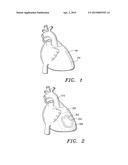 Method and System for Treatment of Damaged Biological Tissue diagram and image