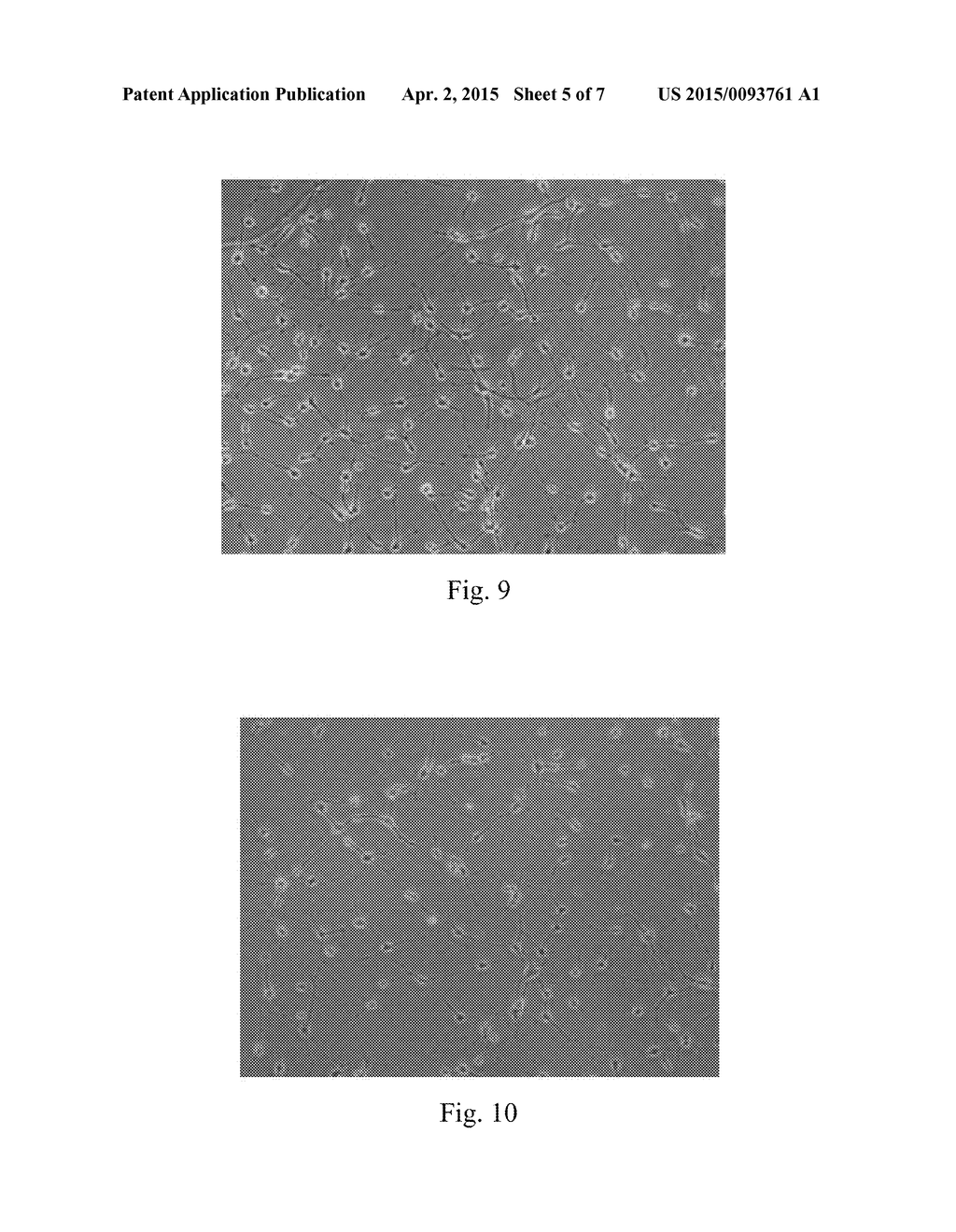 Differentiation and amplification method for inducing human     neuralstem/progenitor cells to differentiate into oligodendrocyte     progenitor cells andapplication thereof - diagram, schematic, and image 06