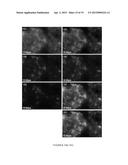 METHODS FOR THE DIAGNOSIS OR PROGNOSIS OF BREAST CANCER diagram and image