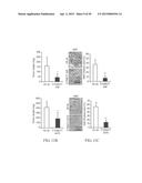 METHOD FOR TREATING CELL PROLIFERATIVE DISORDER BY INHIBITING C1GALT1     EXPRESSION diagram and image