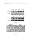 METHOD FOR TREATING CELL PROLIFERATIVE DISORDER BY INHIBITING C1GALT1     EXPRESSION diagram and image