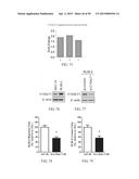 METHOD FOR TREATING CELL PROLIFERATIVE DISORDER BY INHIBITING C1GALT1     EXPRESSION diagram and image