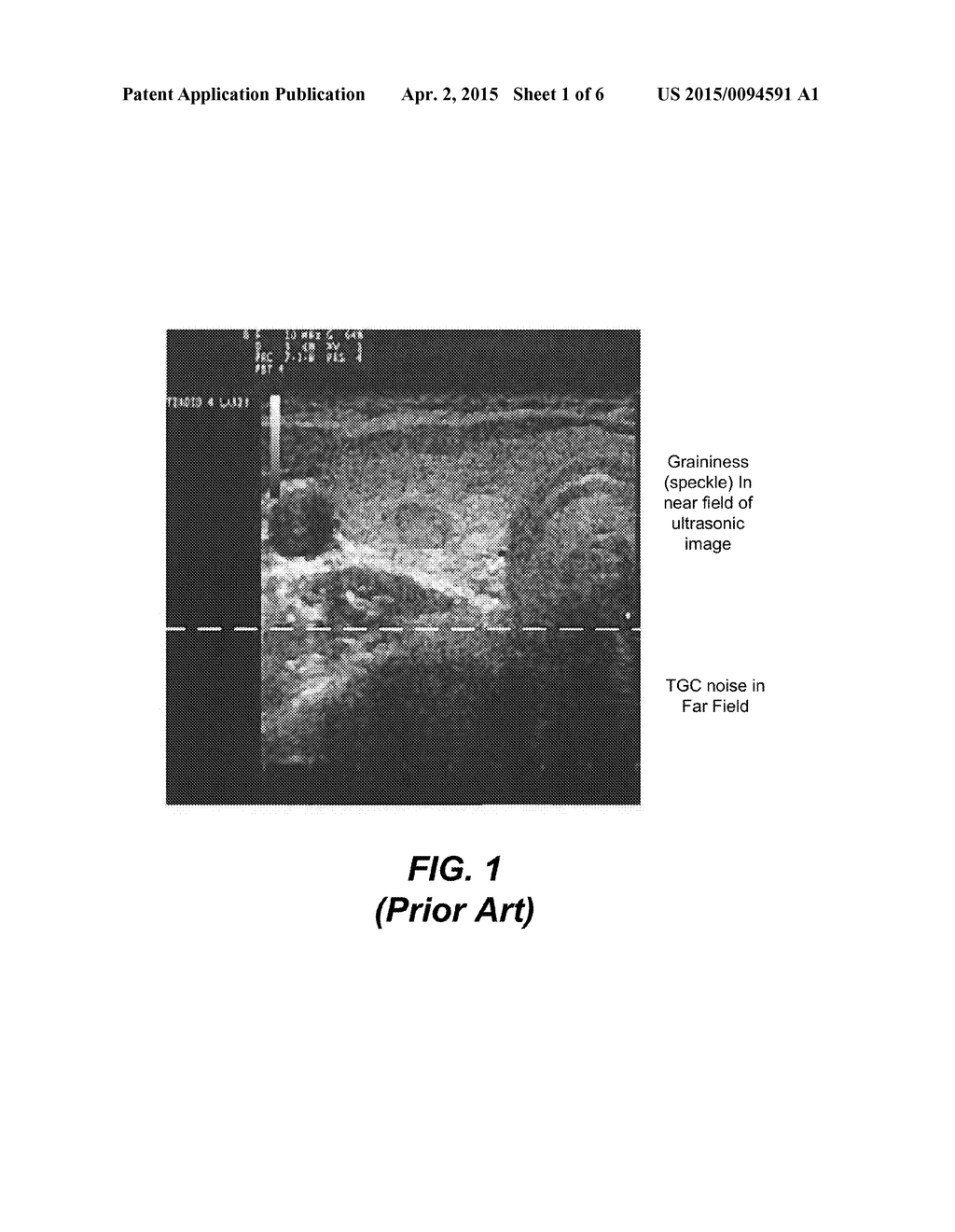 SPECKLE AND NOISE REDUCTION IN ULTRASOUND IMAGES - diagram, schematic, and image 02
