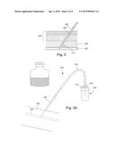 SYSTEMS AND METHODS FOR PARENTERALLY PROCURING BODILY-FLUID SAMPLES WITH     REDUCED CONTAMINATION diagram and image