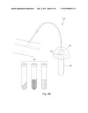 SYSTEMS AND METHODS FOR PARENTERALLY PROCURING BODILY-FLUID SAMPLES WITH     REDUCED CONTAMINATION diagram and image