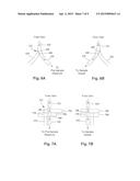 SYSTEMS AND METHODS FOR PARENTERALLY PROCURING BODILY-FLUID SAMPLES WITH     REDUCED CONTAMINATION diagram and image