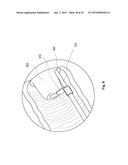 DEVICES AND METHODS FOR CERVIX MEASUREMENT diagram and image