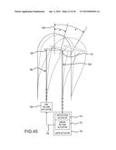 CATHETER HAVING AN ACTIVE RETURN-TO-STRAIGHT MECHANISM diagram and image