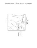 SURGICAL SYSTEM FOR AND A METHOD OF DISSECTION OF TISSUE AWAY FROM AN     ORGAN OR BODY LUMEN diagram and image