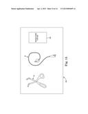 SURGICAL SYSTEM FOR AND A METHOD OF DISSECTION OF TISSUE AWAY FROM AN     ORGAN OR BODY LUMEN diagram and image