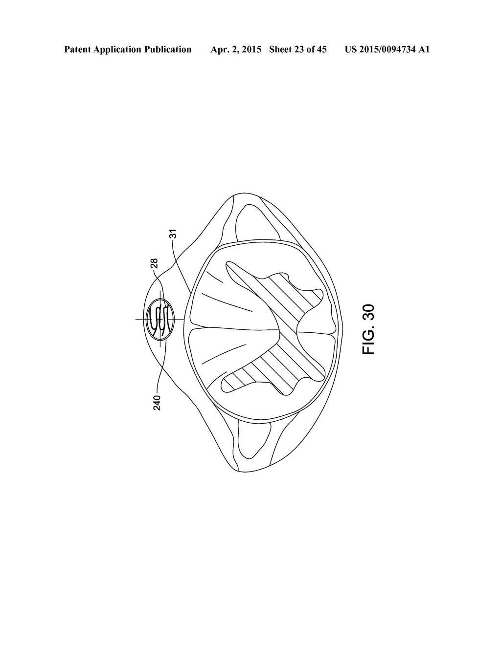 ELECTRODE ARRAY AND DEPLOYMENT ASSEMBLY INCLUDING AN ELECTRODE ARRAY THAT     IS FOLDED INTO A CANNULA THAT IS NARROWER IN WIDTH THAN THE ARRAY - diagram, schematic, and image 24