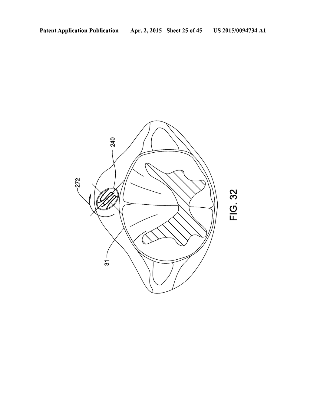 ELECTRODE ARRAY AND DEPLOYMENT ASSEMBLY INCLUDING AN ELECTRODE ARRAY THAT     IS FOLDED INTO A CANNULA THAT IS NARROWER IN WIDTH THAN THE ARRAY - diagram, schematic, and image 26