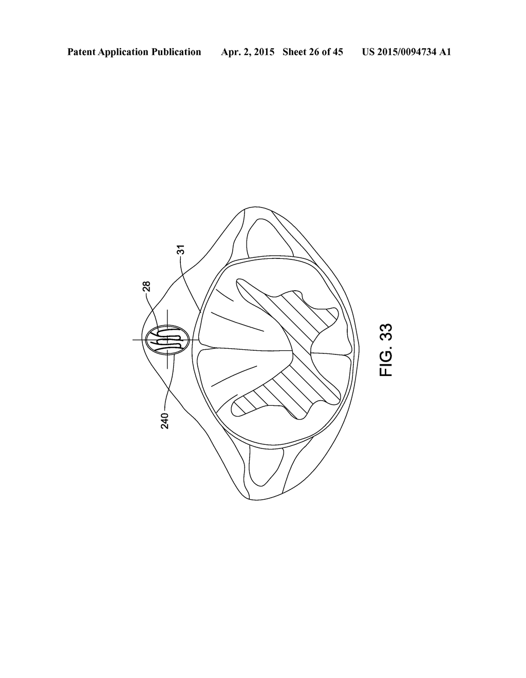 ELECTRODE ARRAY AND DEPLOYMENT ASSEMBLY INCLUDING AN ELECTRODE ARRAY THAT     IS FOLDED INTO A CANNULA THAT IS NARROWER IN WIDTH THAN THE ARRAY - diagram, schematic, and image 27