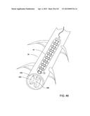 ELECTRODE ARRAY AND DEPLOYMENT ASSEMBLY INCLUDING AN ELECTRODE ARRAY THAT     IS FOLDED INTO A CANNULA THAT IS NARROWER IN WIDTH THAN THE ARRAY diagram and image