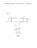 VASCULAR ANASTOMOSIS STENT diagram and image