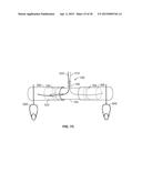 VASCULAR ANASTOMOSIS STENT diagram and image