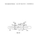 VASCULAR ANASTOMOSIS STENT diagram and image