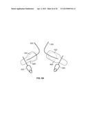 VASCULAR ANASTOMOSIS STENT diagram and image