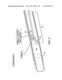 SYSTEMS AND METHODS FOR PERCUTANEOUS OCCLUSION CROSSING diagram and image