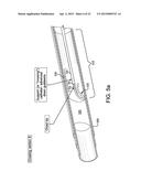 SYSTEMS AND METHODS FOR PERCUTANEOUS OCCLUSION CROSSING diagram and image