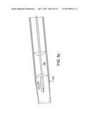 SYSTEMS AND METHODS FOR PERCUTANEOUS OCCLUSION CROSSING diagram and image