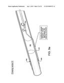 SYSTEMS AND METHODS FOR PERCUTANEOUS OCCLUSION CROSSING diagram and image