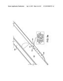 SYSTEMS AND METHODS FOR PERCUTANEOUS OCCLUSION CROSSING diagram and image