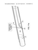 SYSTEMS AND METHODS FOR PERCUTANEOUS OCCLUSION CROSSING diagram and image