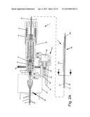 THROMBECTOMY AND SOFT DEBRIS REMOVAL DEVICE diagram and image