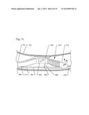 THROMBECTOMY AND SOFT DEBRIS REMOVAL DEVICE diagram and image