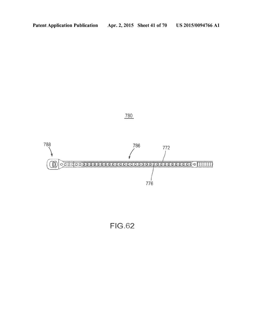 DEVICE AND METHOD FOR REINFORCEMENT OF A FACET - diagram, schematic, and image 42