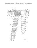 Bone Plate System for Osteosynthesis diagram and image