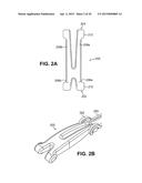 SCLERAL PROSTHESIS FOR TREATING PRESBYOPIA AND OTHER EYE DISORDERS AND     RELATED DEVICES AND METHODS diagram and image