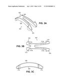 SCLERAL PROSTHESIS FOR TREATING PRESBYOPIA AND OTHER EYE DISORDERS AND     RELATED DEVICES AND METHODS diagram and image