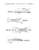 SCLERAL PROSTHESIS FOR TREATING PRESBYOPIA AND OTHER EYE DISORDERS AND     RELATED DEVICES AND METHODS diagram and image