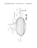 Aerodynamic Trimmer Head For Use In Flexible Line Rotary Trimmers diagram and image