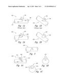 SELF-RETAINING SUTURES INCLUDING TISSUE RETAINERS HAVING IMPROVED STRENGTH diagram and image