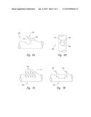 SELF-RETAINING SUTURES INCLUDING TISSUE RETAINERS HAVING IMPROVED STRENGTH diagram and image