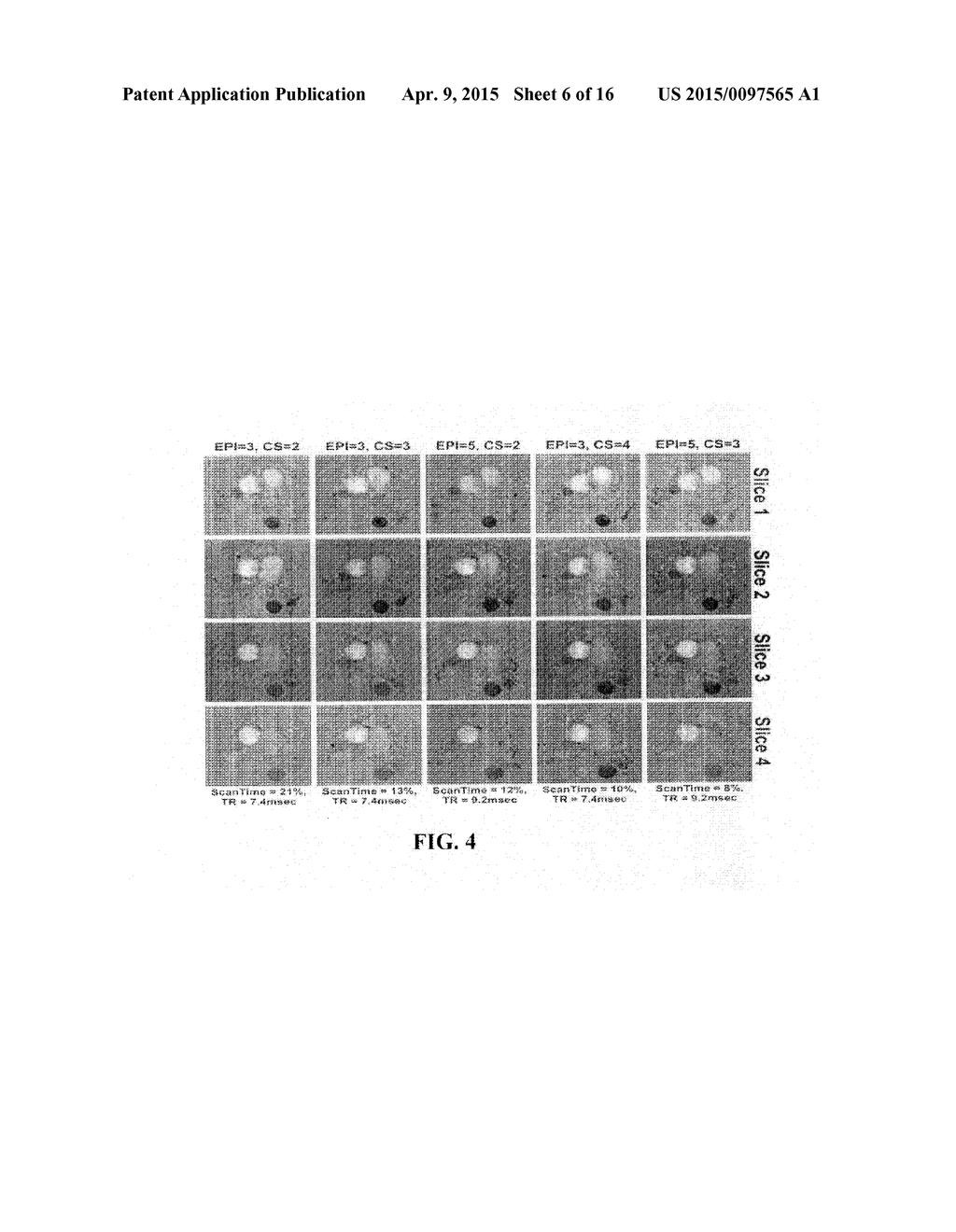 METHODS AND APPARATUS FOR REDUCING SCAN TIME OF PHASE CONTRAST MRI - diagram, schematic, and image 07