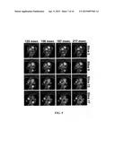 METHODS AND APPARATUS FOR REDUCING SCAN TIME OF PHASE CONTRAST MRI diagram and image