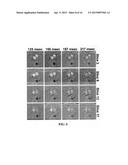 METHODS AND APPARATUS FOR REDUCING SCAN TIME OF PHASE CONTRAST MRI diagram and image