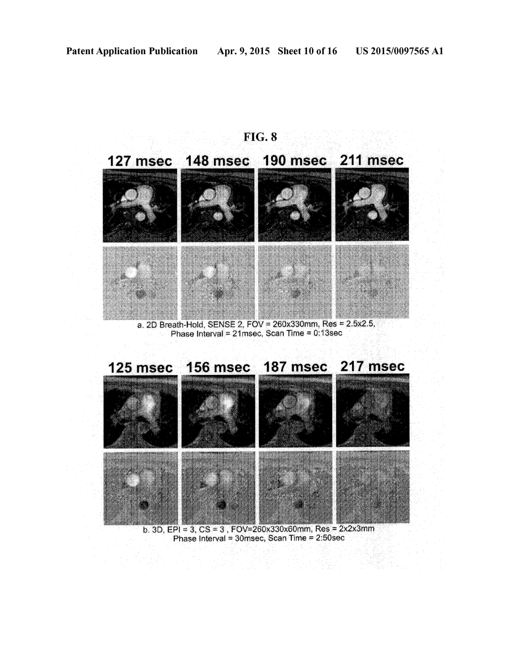 METHODS AND APPARATUS FOR REDUCING SCAN TIME OF PHASE CONTRAST MRI - diagram, schematic, and image 11