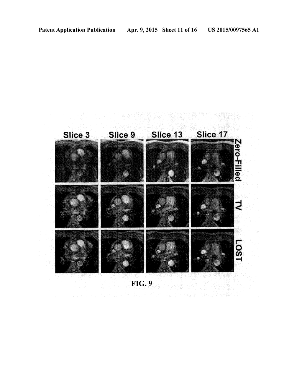 METHODS AND APPARATUS FOR REDUCING SCAN TIME OF PHASE CONTRAST MRI - diagram, schematic, and image 12