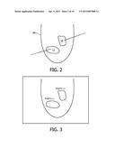 CLINICAL WORKSTATION INTEGRATING MEDICAL IMAGING AND BIOPSY DATA AND     METHODS USING SAME diagram and image