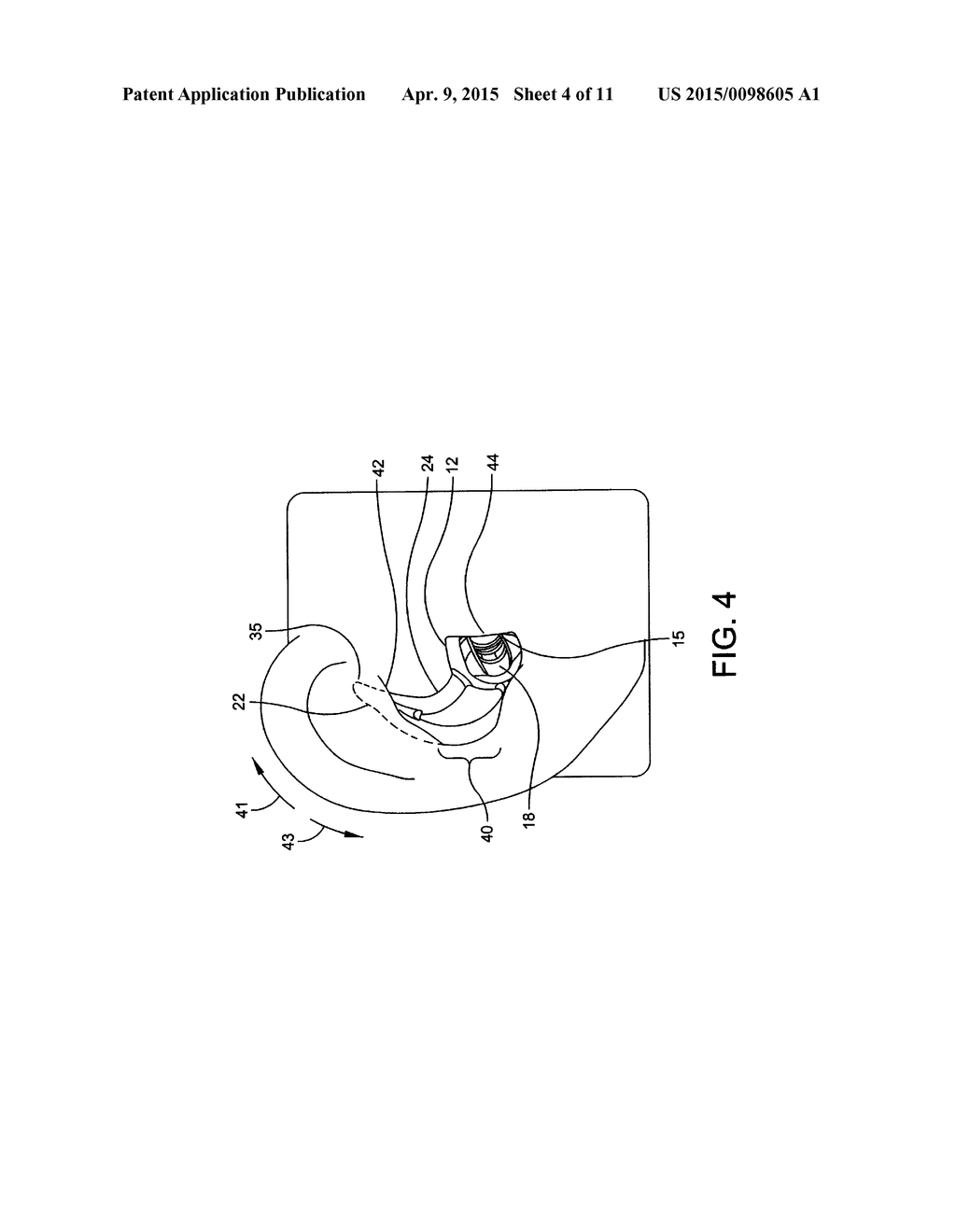 EARPIECE POSITIONING AND RETAINING - diagram, schematic, and image 05