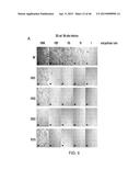 PEPTIDES THAT TARGET DORSAL ROOT GANGLION NEURONS diagram and image