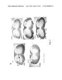 PEPTIDES THAT TARGET DORSAL ROOT GANGLION NEURONS diagram and image