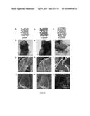 LARGE-VOLUME-CHANGE LITHIUM BATTERY ELECTRODES diagram and image