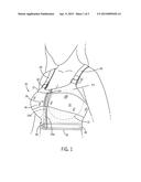 POST SURGICAL RECOVERY BRA diagram and image