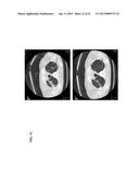 COMPOSITIONS AND METHODS FOR TREATING CANCERS diagram and image